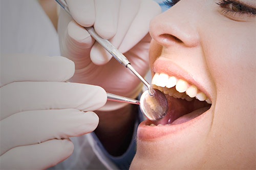 Start Fresh This Year With a January Dental Renewal
