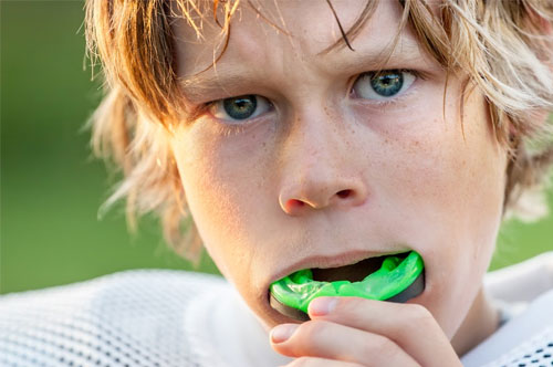 Summer Sports & Dental Safety: Protecting Your Smile